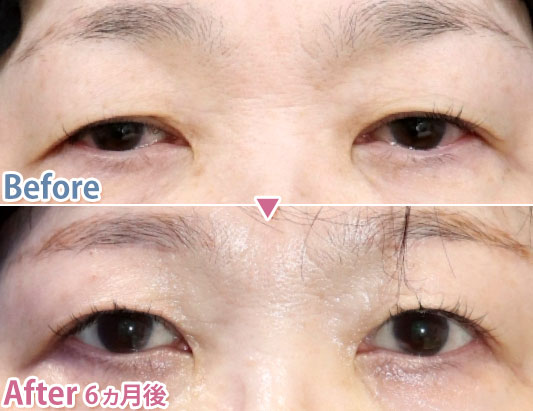 症例写真