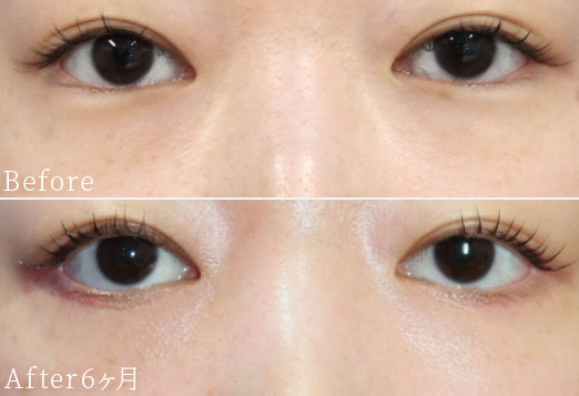 症例写真