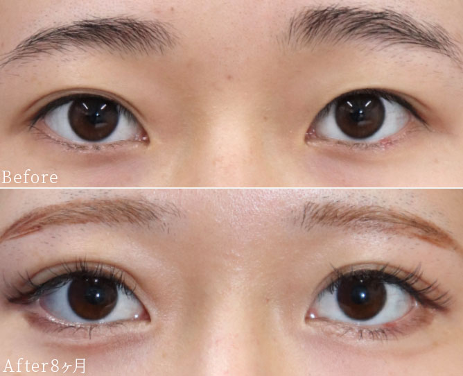 症例写真