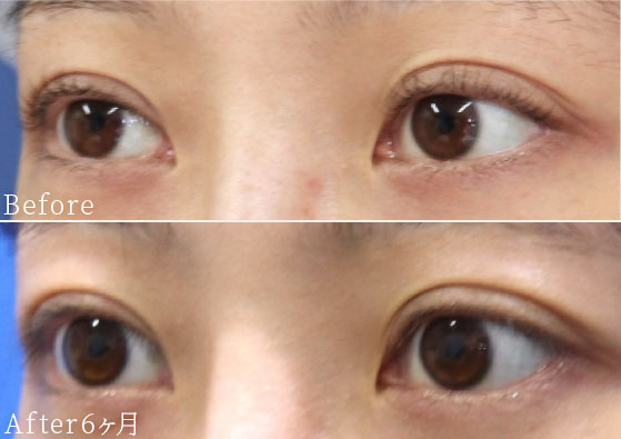 症例写真