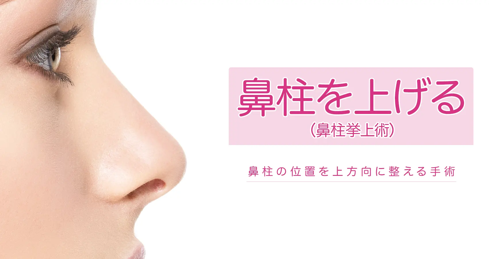 鼻柱を上げる(鼻柱挙上術)鼻柱の位置を上方向に整える手術