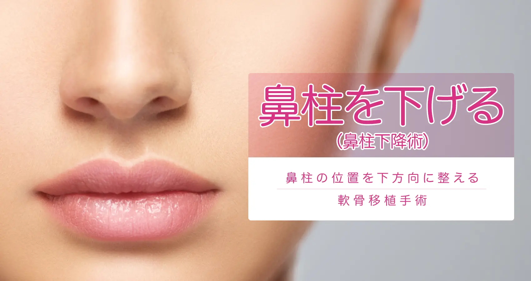 鼻柱を下げる（鼻柱下降術）鼻柱を整える軟骨移植手術