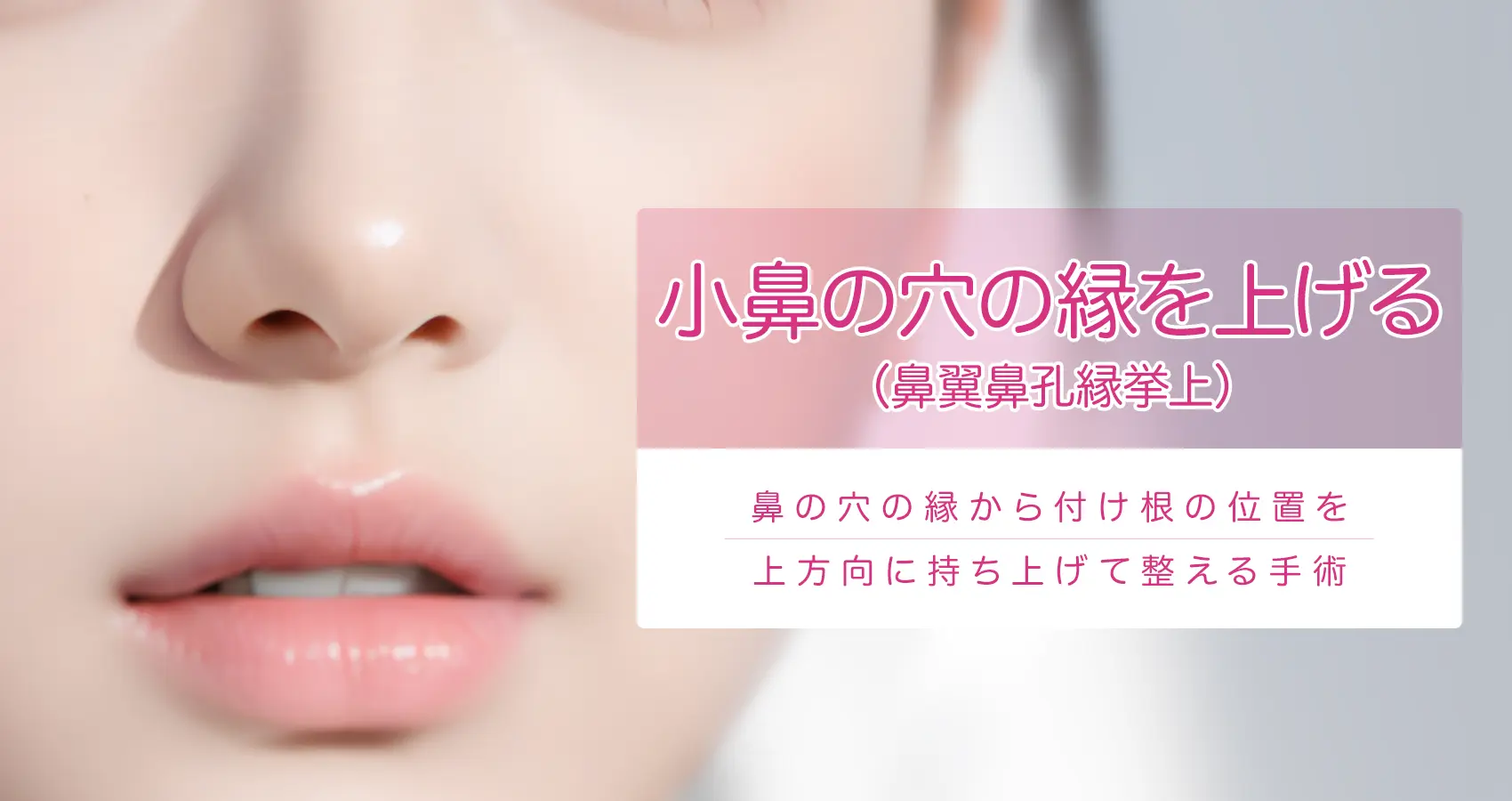 小鼻の穴の縁を上げる（鼻翼鼻孔縁挙上）鼻の穴の縁から付け根の位置を上方向に持ち上げて整える手術