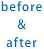 before&after